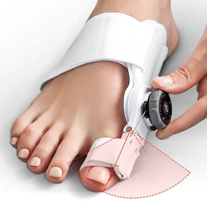 Adjustable bunion corrector showcasing foot relief solution; aligns toes, aids in correcting bunions, and ensures daily comfo