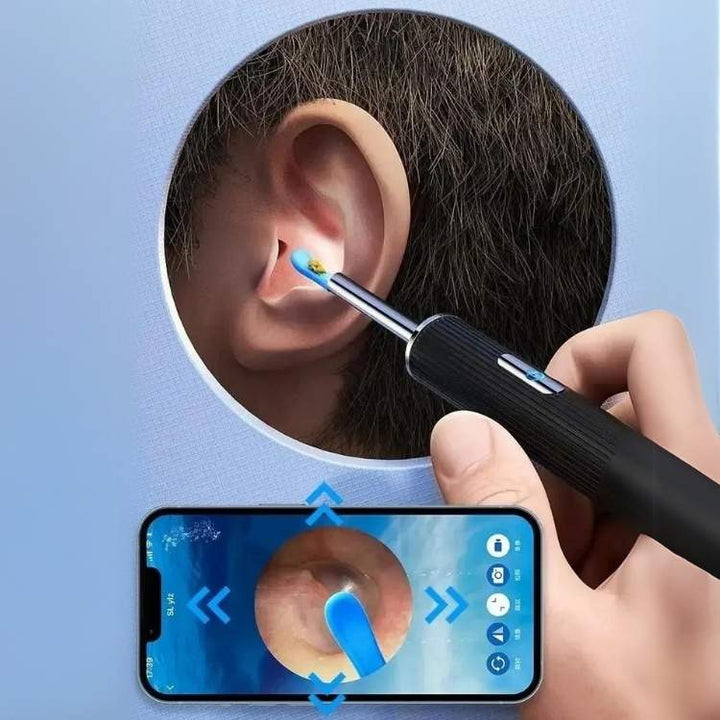 EarScope Pro Wax Removal Kit with camera and LED lights, showcasing its sleek design and effectiveness for ear cleaning.
