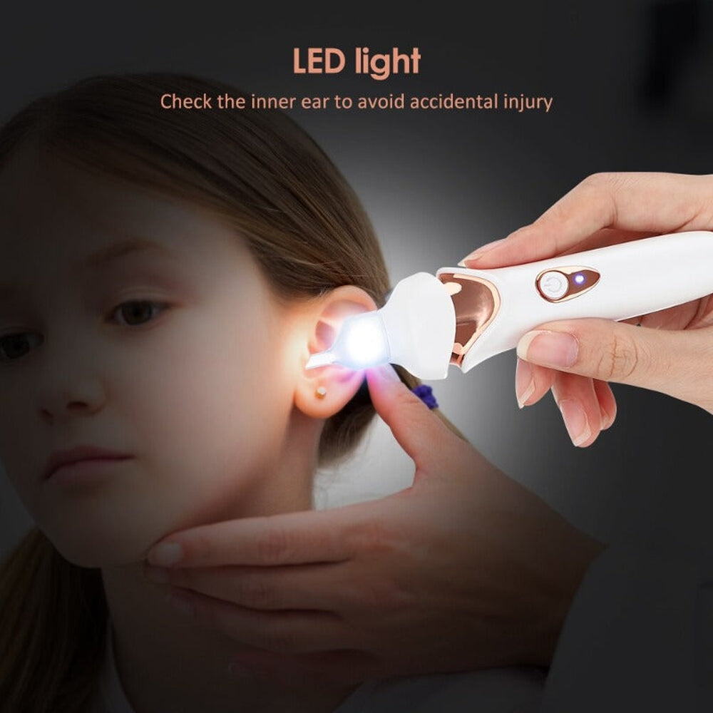 Painless earwax vacuum cleaner for gentle home ear care, featuring LED light & USB rechargeable design.