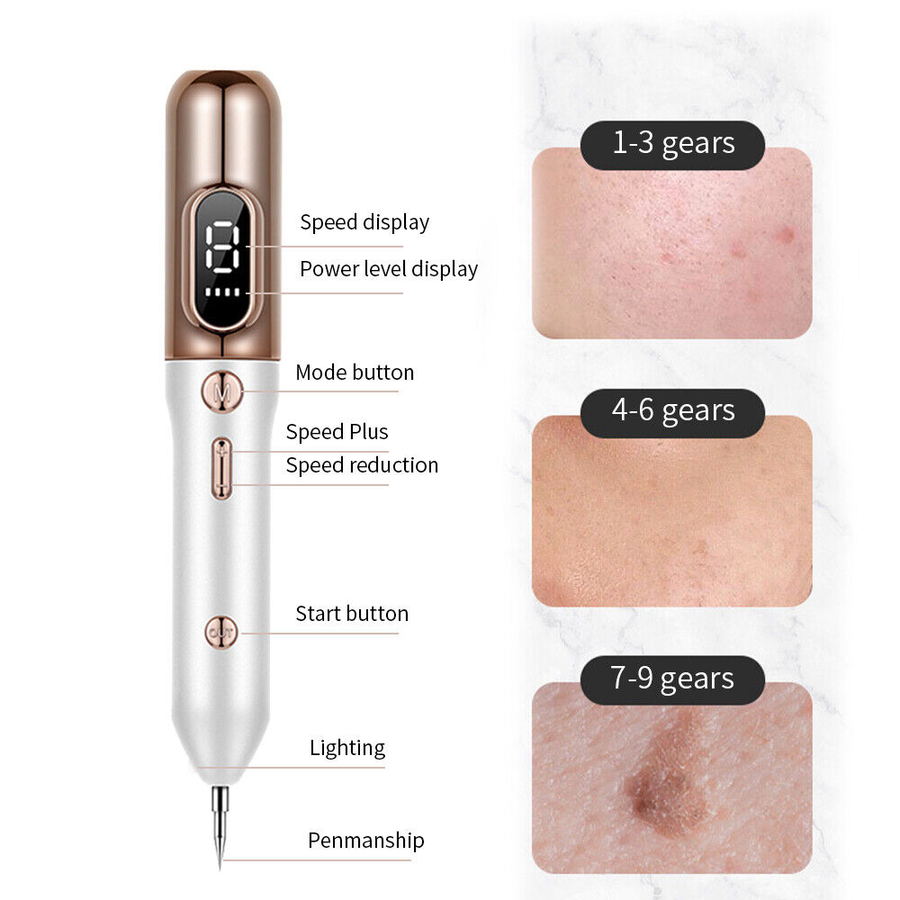 Close-up of a plasma pen used for precise skin tag removal, a powerful at-home skin treatment device.